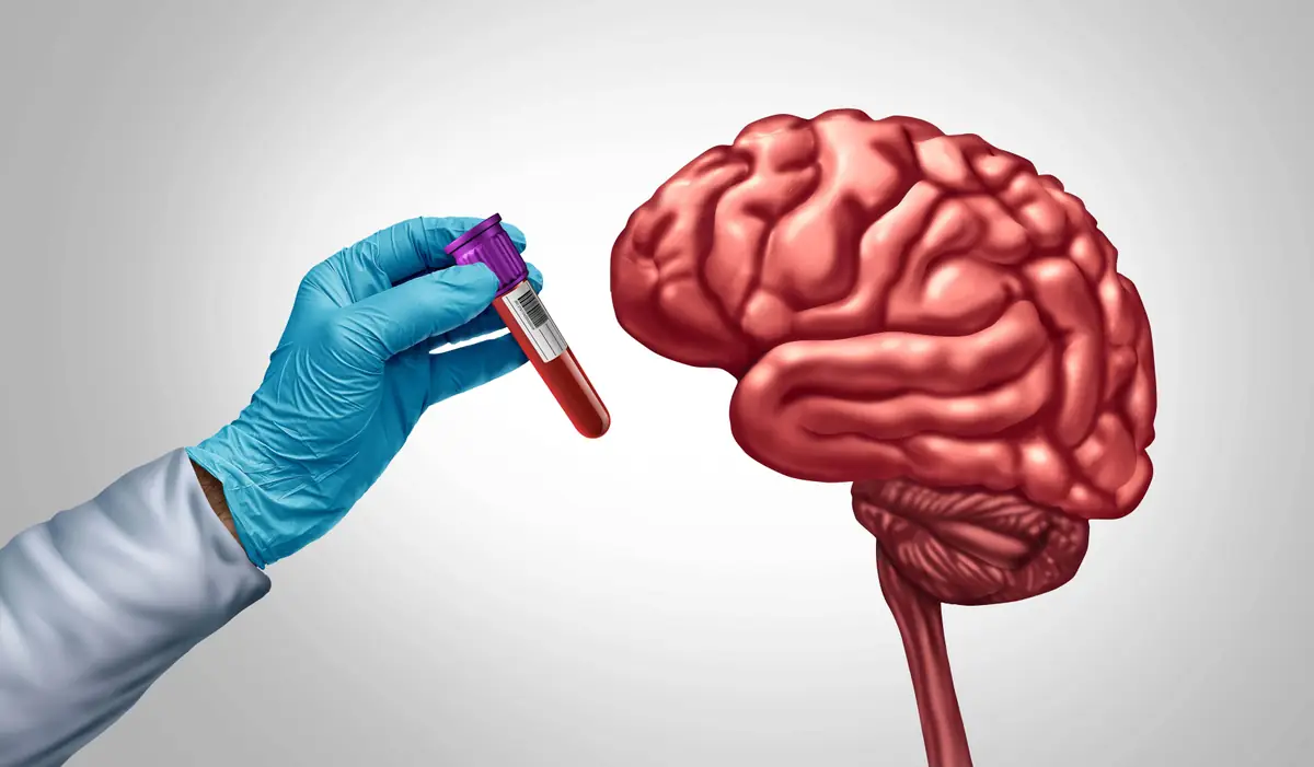 Alzheimer Brain Diagnostics Analysis Illustration